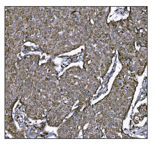 Anti-LRP1B Antibody Boster Bio