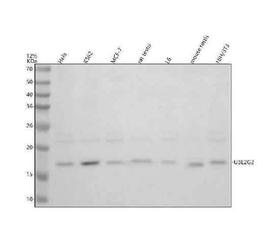 Anti-UBE2G2 Antibody Picoband® Boster Bio