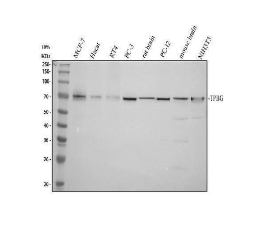Anti-TPBG Antibody Picoband® Boster Bio