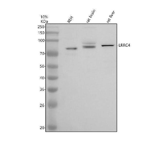 Anti-LRRC4 Antibody Picoband® Boster Bio