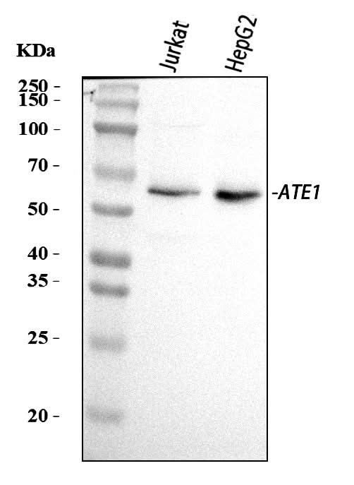 Anti-ATE1 Antibody Picoband® Boster Bio