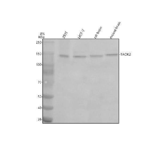 Anti-TAOK2 Antibody Picoband® Boster Bio