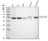 Anti-LPCAT2 Antibody Picoband® Boster Bio