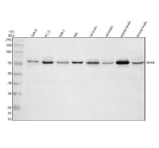 Anti-SNRK Antibody Picoband® Boster Bio