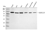 Anti-OSBPL10 Antibody Picoband® Boster Bio