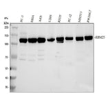 Anti-RBM25 Antibody Picoband® Boster Bio