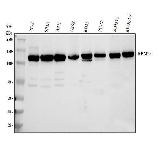 Anti-RBM25 Antibody Picoband® Boster Bio