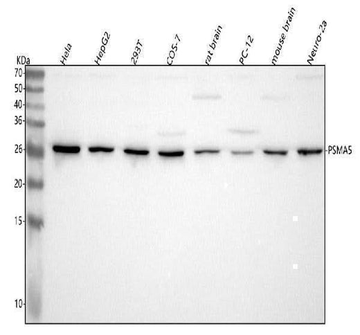 Anti-PSMA5 Antibody Picoband® Boster Bio
