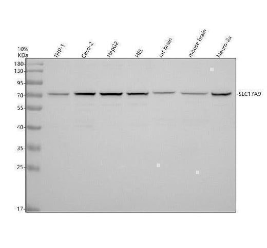 Anti-SLC17A9 Antibody Picoband® Boster Bio