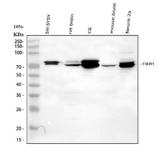 Anti-TBR1 Antibody Picoband® Boster Bio