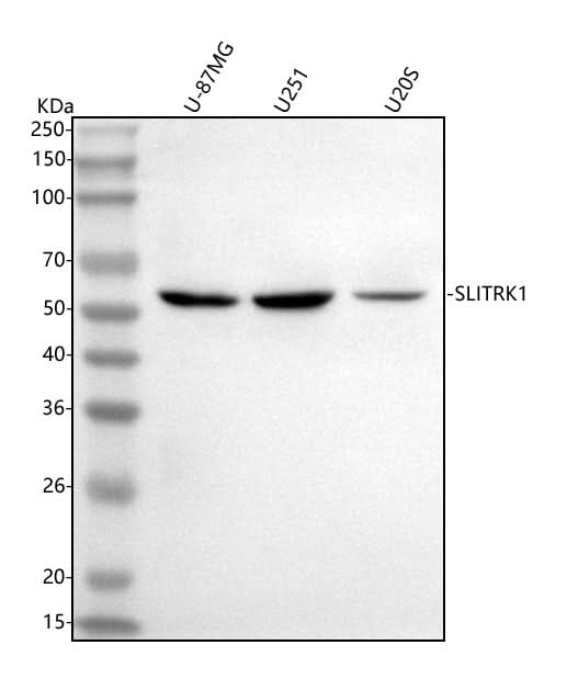 Anti-SLITRK1 Antibody Picoband® Boster Bio