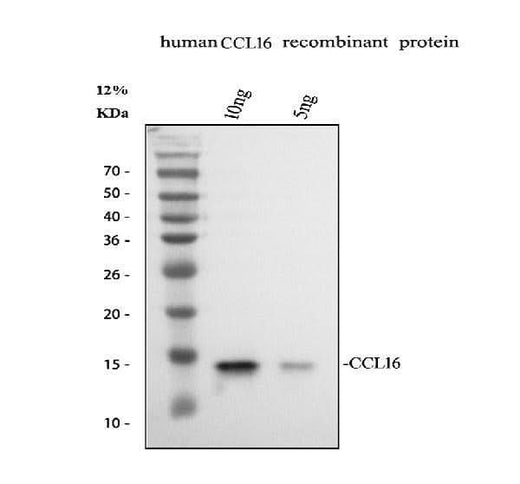 Anti-CCL16 Antibody Picoband® Boster Bio