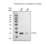 Anti-CCL16 Antibody Picoband® Boster Bio
