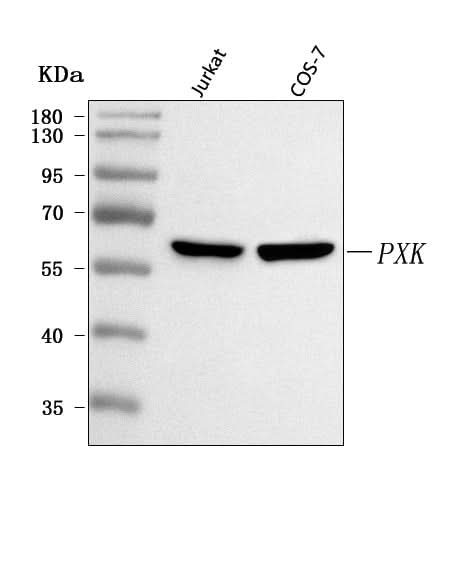 Anti-PXK Antibody Picoband® Boster Bio