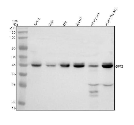 Anti-ECHDC2 Antibody Picoband® Boster Bio