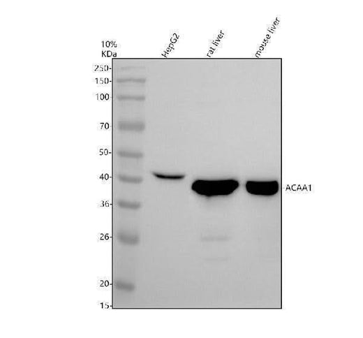 Anti-ECHDC3 Antibody Picoband® Boster Bio