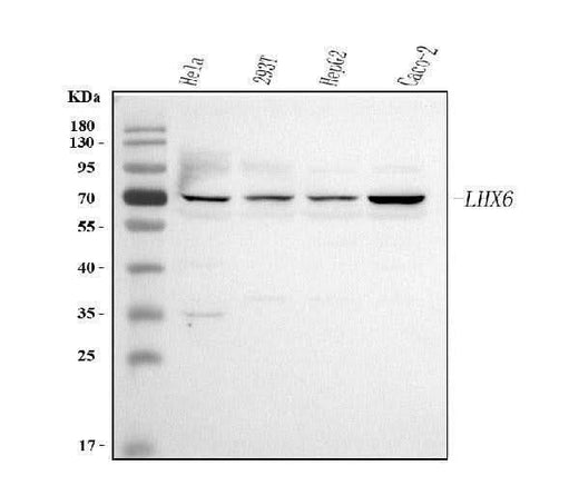 Anti-LHX6 Antibody Picoband® Boster Bio