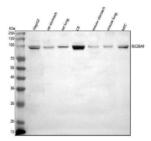 Anti-SLC26A9 Antibody Picoband® Boster Bio