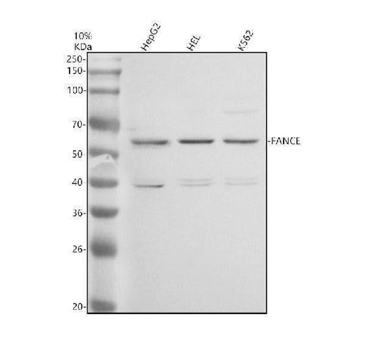 Anti-FANCE Antibody Picoband® Boster Bio