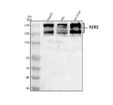 Anti-RERE Antibody Picoband® Boster Bio