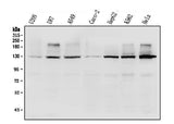 Anti-R-Cadherin-4 CDH4-Antibody Picoband® Boster Bio