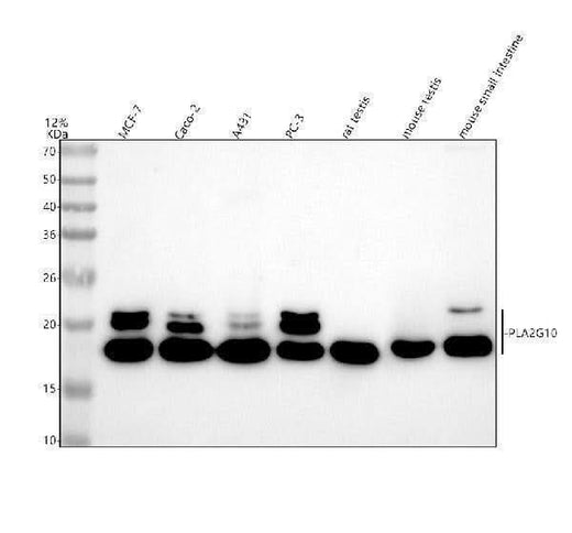 Anti-PLA2G10 Antibody Picoband® Boster Bio