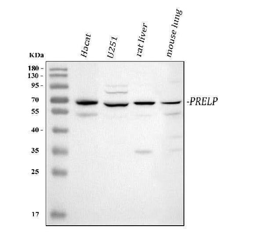 Anti-PRELP Antibody Picoband® Boster Bio