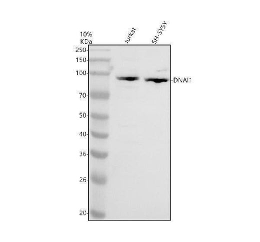 Anti-ECM2 Antibody Picoband® Boster Bio