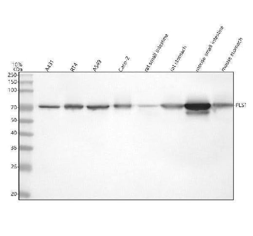 Anti-PLS1 Antibody Picoband® Boster Bio