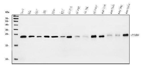 Anti-Proteasome 20S beta 6/PSMB6 Antibody Picoband® Boster Bio