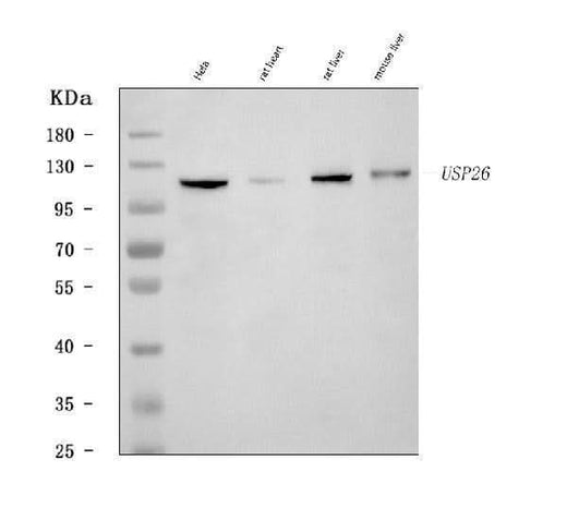 Anti-USP26 Antibody Picoband® Boster Bio