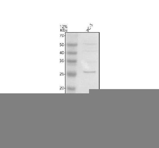 Anti-UBE2W Antibody Picoband® Boster Bio