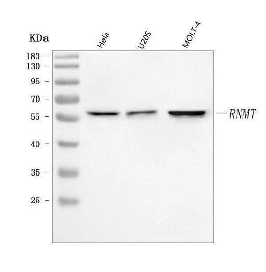 Anti-RNMT Antibody Picoband® Boster Bio