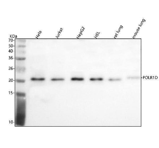 Anti-POLR1D Antibody Picoband® Boster Bio