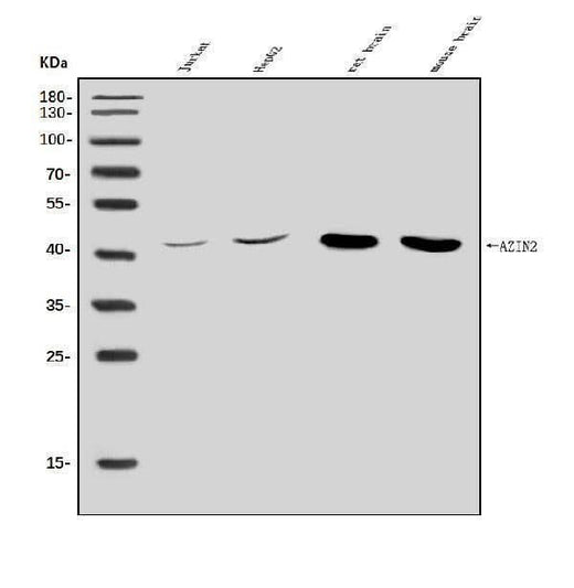 Anti-Arginine decarboxylase/AZIN2 Antibody Picoband® Boster Bio