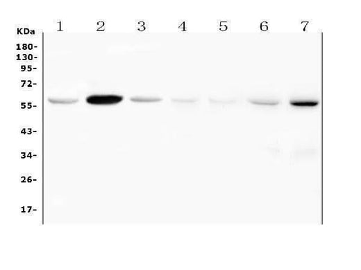 Anti-Fascin 2/FSCN2 Antibody Picoband® Boster Bio