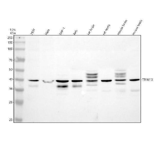 Anti-TRIM13 Antibody Picoband® Boster Bio