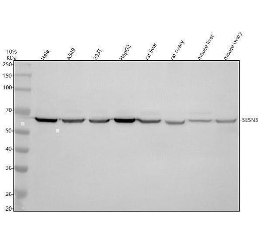Anti-SESN3 Antibody Picoband® Boster Bio