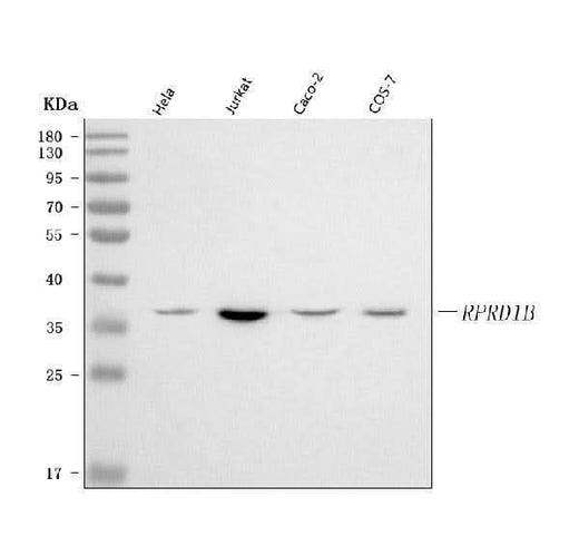 Anti-RPRD1B Antibody Picoband® Boster Bio