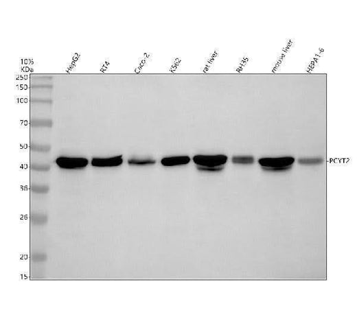 Anti-PCYT2 Antibody Picoband® Boster Bio