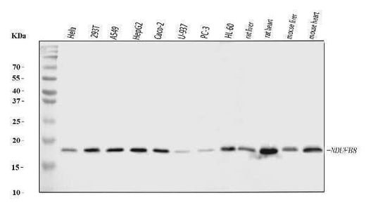 Anti-NDUFB8 Antibody Picoband® Boster Bio