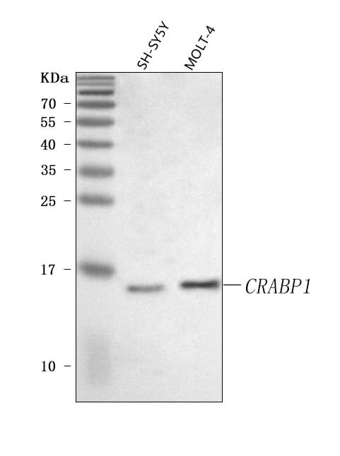 Anti-CRABP1 Antibody Picoband® Boster Bio