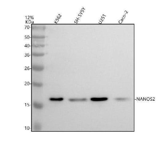 Anti-NANOS2 Antibody Picoband® Boster Bio