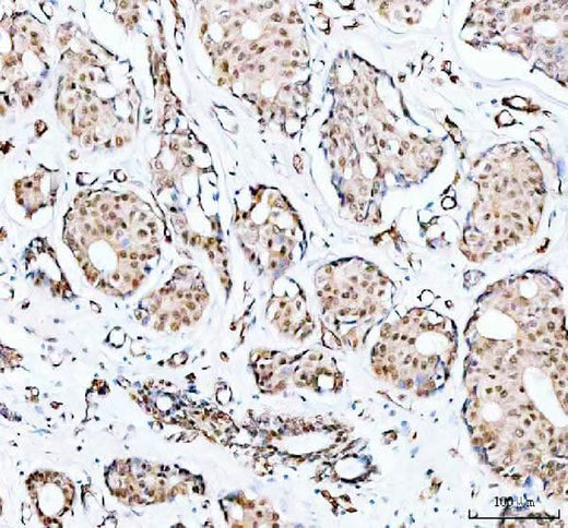Anti-PRMT8 Antibody Picoband® Boster Bio