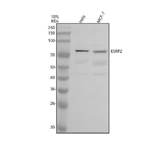 Anti-EIF2S3 Antibody Picoband® Boster Bio
