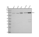 Anti-PYGB Antibody Picoband® Boster Bio