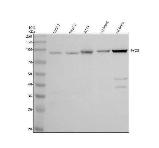 Anti-PYGB Antibody Picoband® Boster Bio