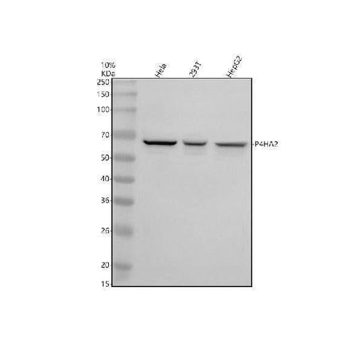 Anti-P4HA2 Antibody Picoband® Boster Bio