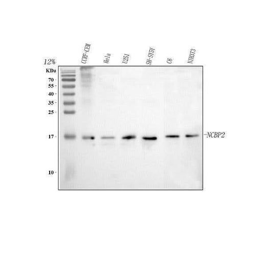 Anti-CBP20/NCBP2 Antibody Picoband® Boster Bio