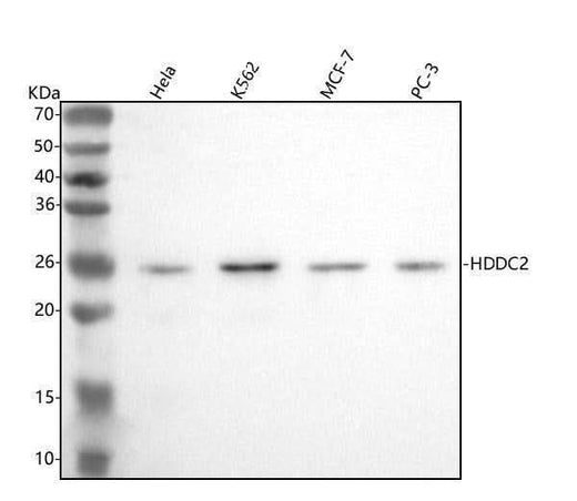 Anti-HDDC2 Antibody Picoband® Boster Bio